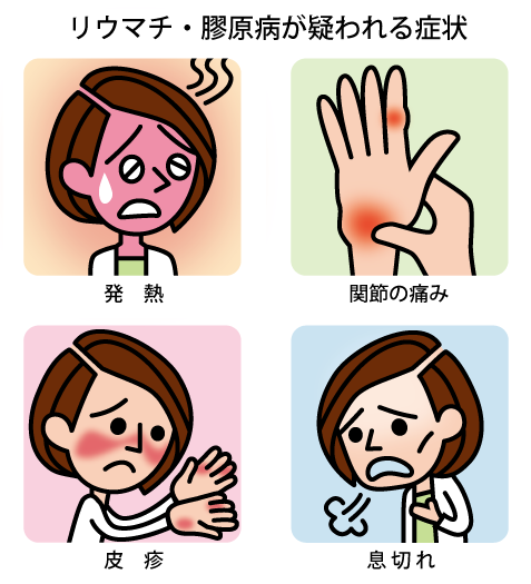 どんな時に膠原病が疑われ、どのように診断されますか?