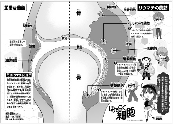 はたらく細胞 関節リウマチ・若年性特発性関節炎における関節炎の病態と抗リウマチ薬の作用機序